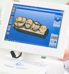 Zahnersatz Eberstadt - Hochwertiger Zahnersatz, Füllungen und Kronen