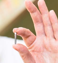 Implantologie Eberstadt - Zahnimplantate und Zahnprothesen